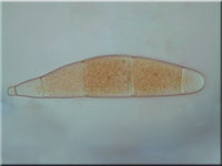 Bactridium flavum