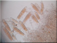 Bactridium flavum