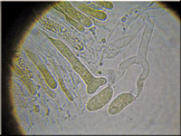 Verschiedensporige Gallerttrne - Dacrymyces variisporus