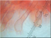 Jupiterbart - Hyphodontia barba-jovis