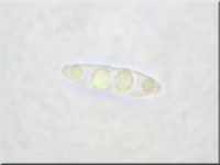 Johannisbeer-Kugelpilz - Diaporthe strumella