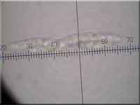 Johannisbeer-Kugelpilz - Diaporthe strumella