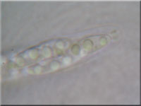 Johannisbeer-Kugelpilz - Diaporthe strumella