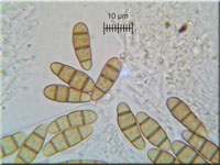 Spaltkohlenpilz - Hysterium angustatum