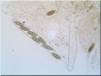 Spaltkohlenpilz - Hysterium angustatum