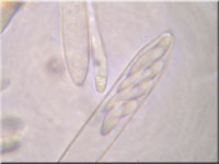 Helles Schilf-Weichbecherchen - Mollisia hydrophila