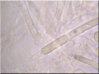 Helles Schilf-Weichbecherchen - Mollisia hydrophila