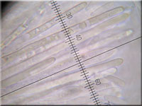 Helles Schilf-Weichbecherchen - Mollisia hydrophila