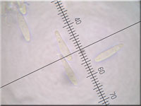 Helles Schilf-Weichbecherchen - Mollisia hydrophila