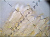 Helles Schilf-Weichbecherchen - Mollisia hydrophila