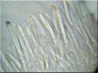 Aschgraues Weichbecherchen - Mollisia lividofusca