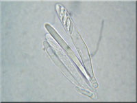 Aschgraues Weichbecherchen - Mollisia lividofusca