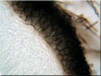 Weidenröschen-Einsenkbecherchen - Pyrenopeziza chamaenerii