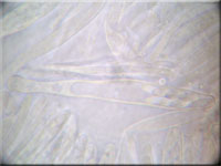 Weidenröschen-Einsenkbecherchen - Pyrenopeziza chamaenerii