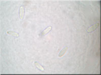 Weidenröschen-Einsenkbecherchen - Pyrenopeziza chamaenerii