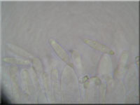Beigefarbenes Rubus-Einsenkbecherchen - Pyrenopeziza dilutella
