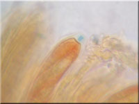 Fruchtschalen-Becherling - Hymenoscyphus fructigenus