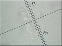 Fruchtschalen-Becherling - Hymenoscyphus fructigenus