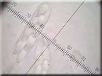 Bartloses Stängelbecherchen - Hymenoscyphus imberbis