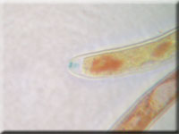 Bartloses Stängelbecherchen - Hymenoscyphus imberbis