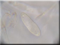 Bartloses Stängelbecherchen - Hymenoscyphus imberbis