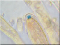 Blasses Erlenbecherchen - Calycellina alniella