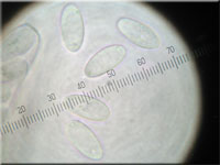 Anemonenbecherling - Dumontinia tuberosa