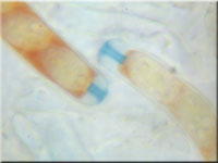Anemonenbecherling - Dumontinia tuberosa