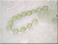 Trockener Kugelpustelpilz - Hypocrea aureoviridis