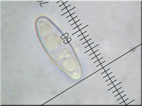 Eingedrckter Pustelpilz - Nectria peziza