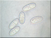 Eingedrckter Pustelpilz - Nectria peziza