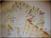 Groer Dickstiel-Kotling - Ascobolus lignatilis