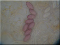 Groer Dickstiel-Kotling - Ascobolus lignatilis