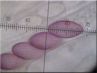 Groer Dickstiel-Kotling - Ascobolus lignatilis