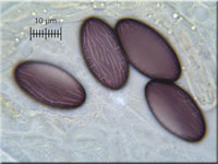 Kleiiger Kotling - Ascobolus stercorarius