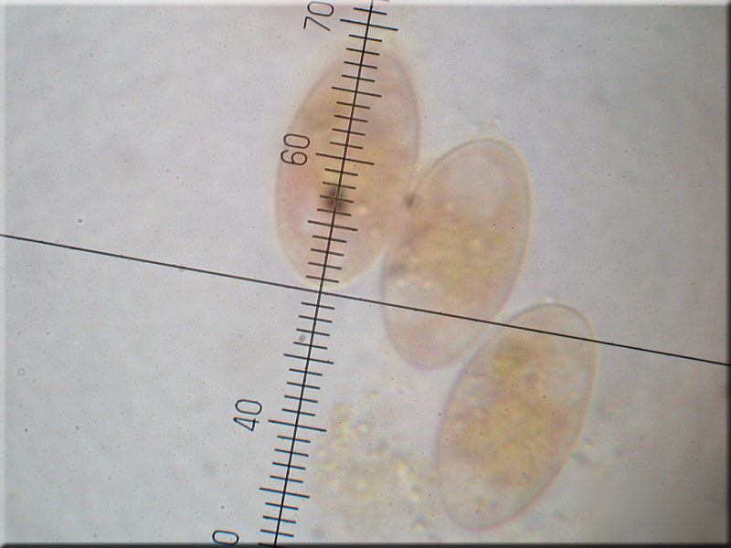 Aderiger Morchelbecherling - Disciotis venosa