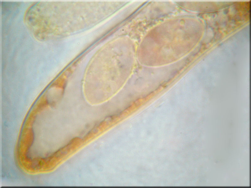 Aderiger Morchelbecherling - Disciotis venosa