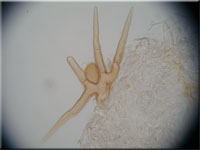 Sternhaariger Erdbostling - Cheilymenia crucipila