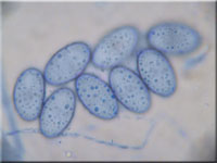 Halbkugeliger Borstenbecherling - Humaria hemisphaerica