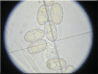 Halbkugeliger Borstenbecherling - Humaria hemisphaerica