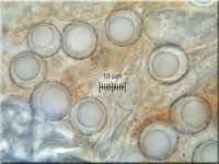 Seaver's Moos-Becherling - Lamprospora seaveri