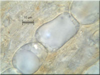 Seaver's Moos-Becherling - Lamprospora seaveri