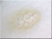 Netzigsporiges Moosschlchen - Neottiella rutilans