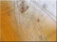 Netzigsporiges Moosschlchen - Neottiella rutilans