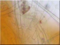 Netzigsporiges Moosschlchen - Neottiella rutilans
