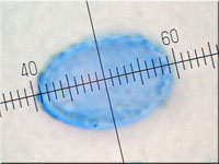 Scutellinia crinita