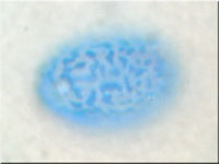 Scutellinia crinita