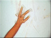 Scutellinia crinita