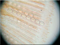Scutellinia crinita