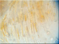 Scutellinia crinita
